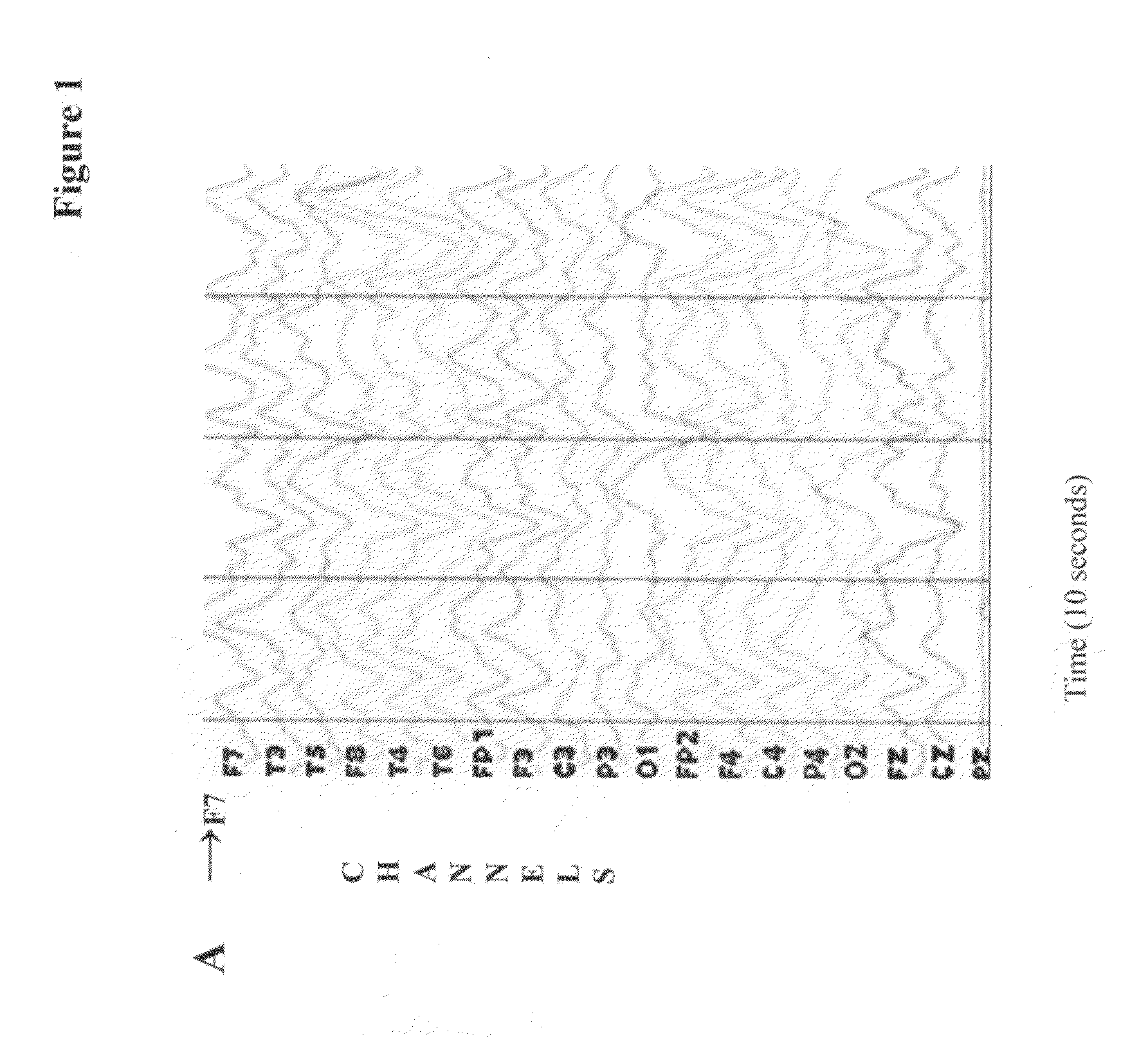 Methods based on fluctuations in cortical synchronization