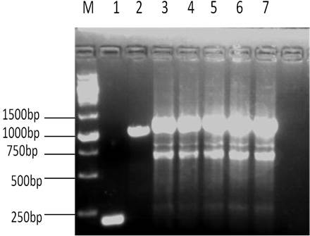 High-immobilization-tendency heparinase I coding gene and protein thereof