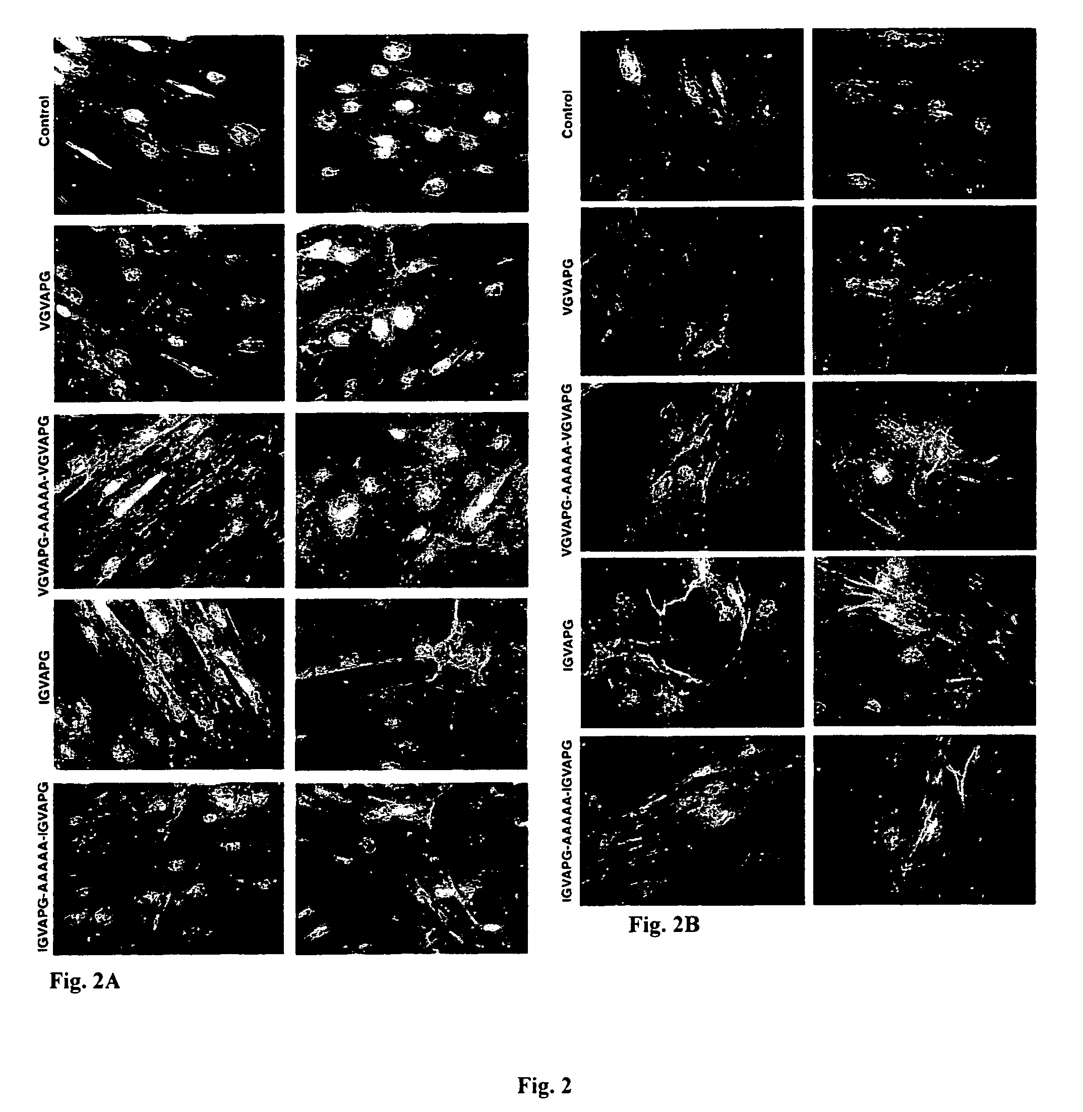 Plant-derived elastin binding protein ligands and methods of using the same