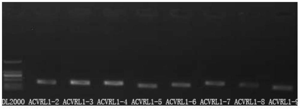 An improved hereditary hemorrhagic telangiectasia related gene mutation detection kit