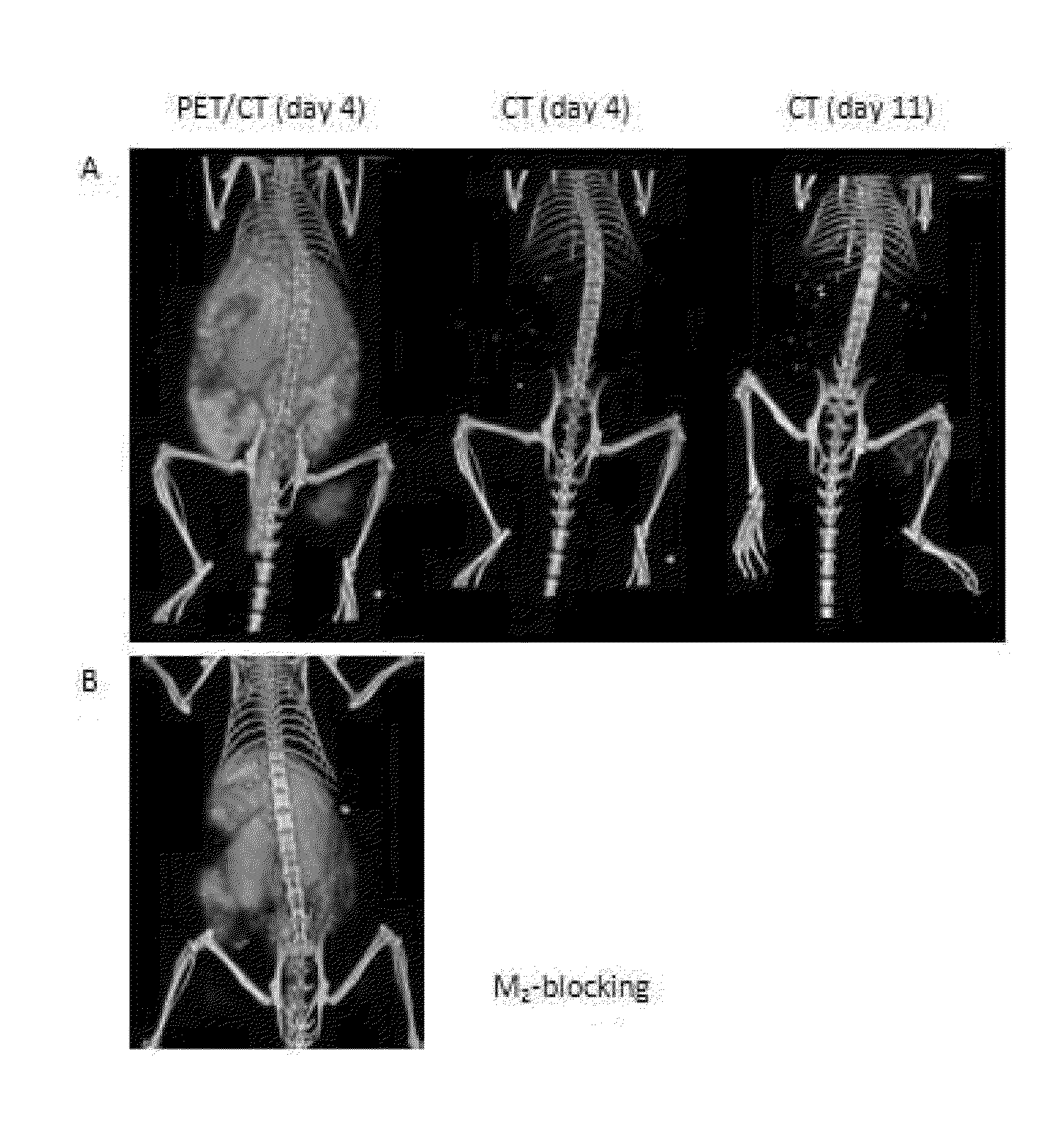 Methods for imaging bone precursor cells using dual-labeled imaging agents to detect mmp-9 positive cells