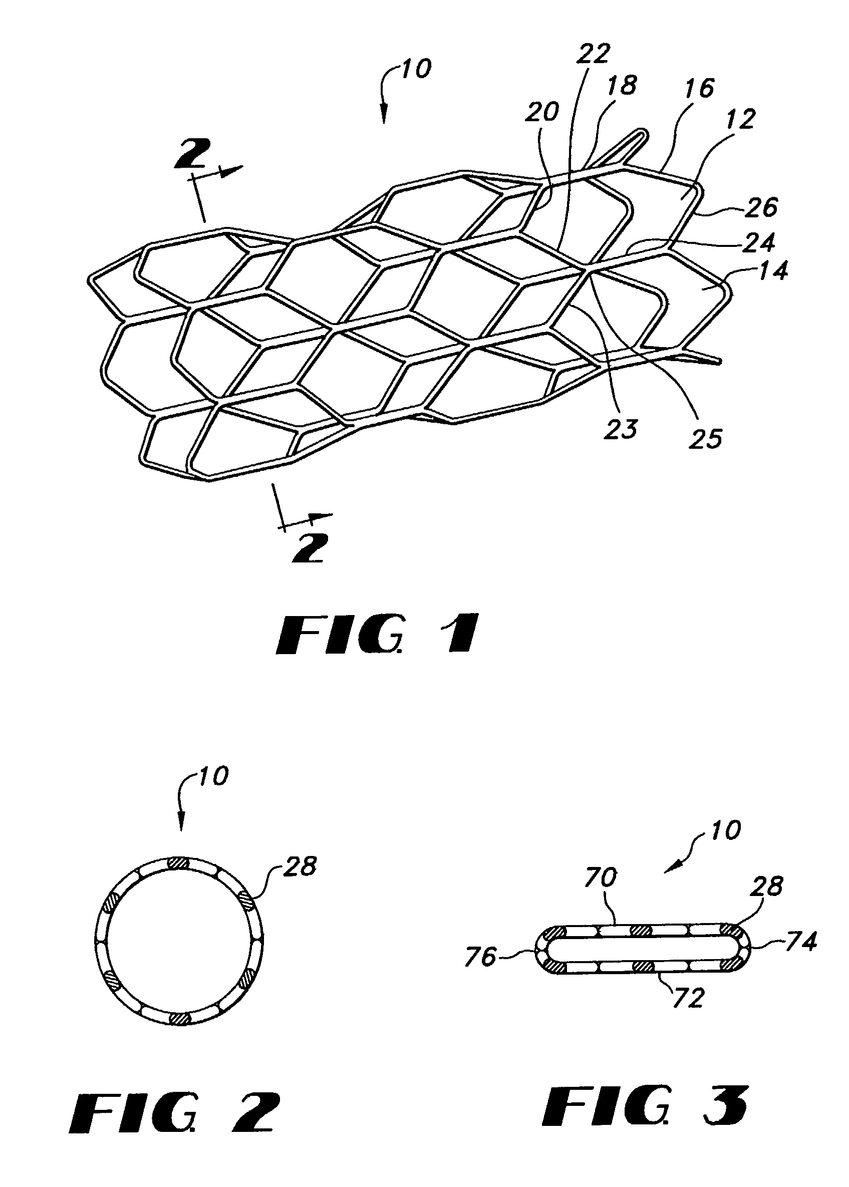 Flat knitted stent and method of making the same