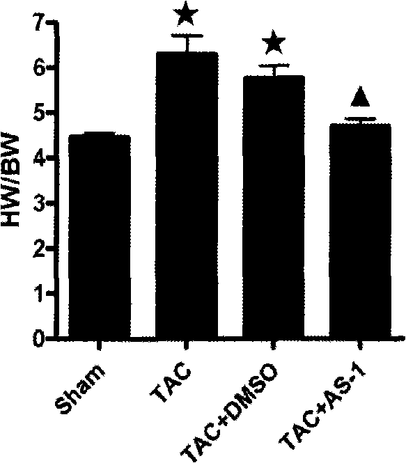 Application of N-[2-methyl-1-(pyrrolidine-1-carbonyl)-propyl]-3-phenyl propionamide in pharmacy