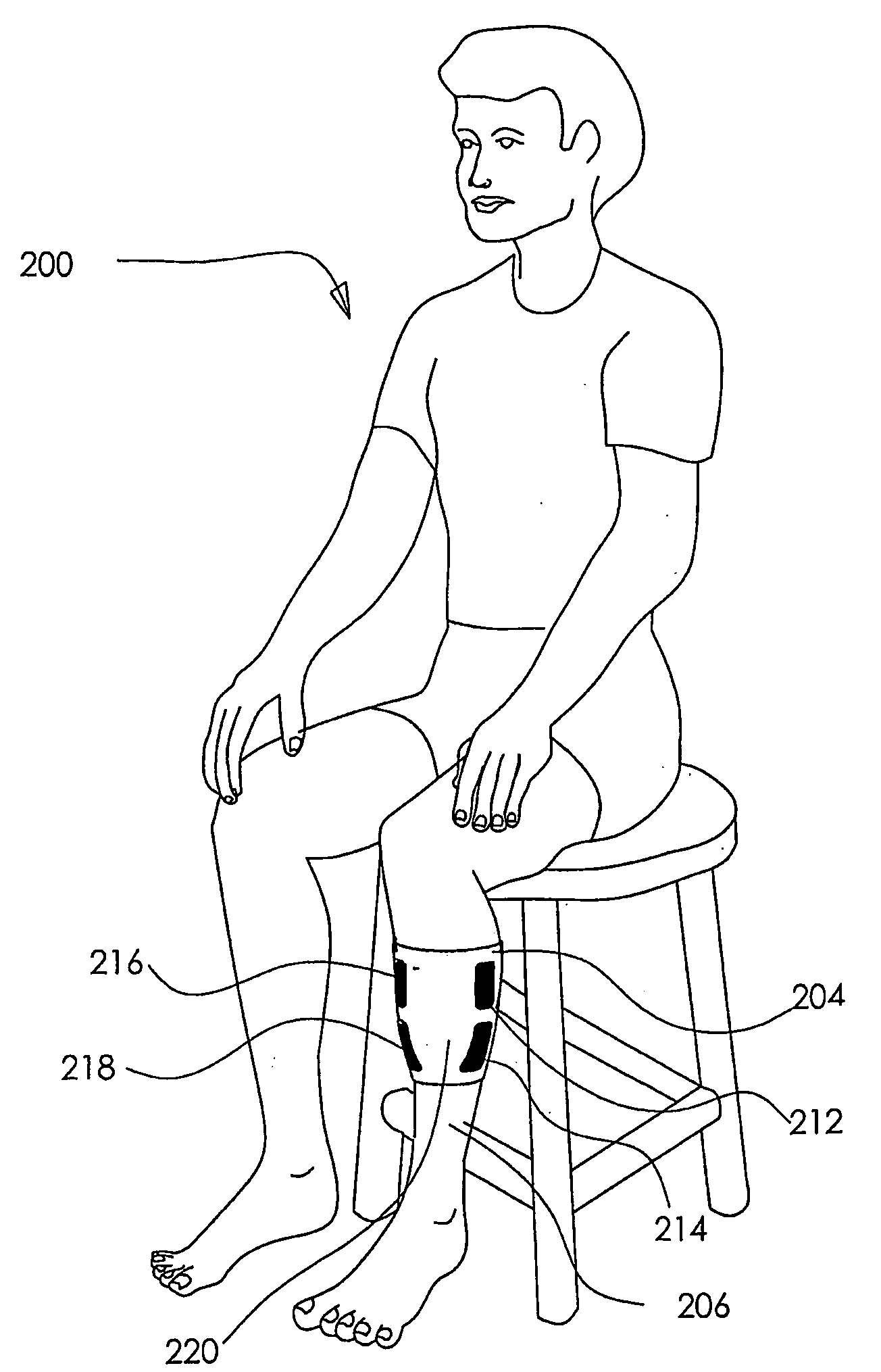 Sleeves for Accommodating a Circulation Enhancement Device