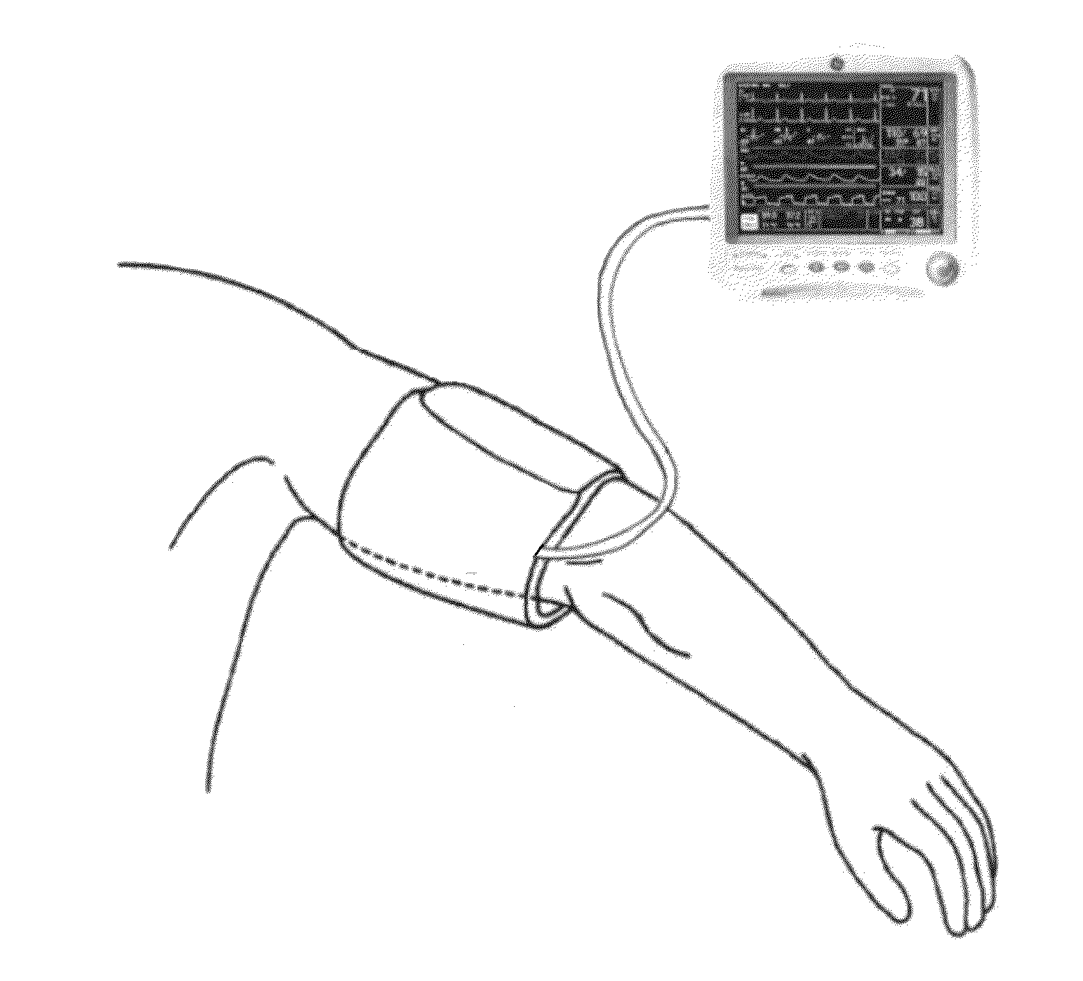 Multi-mode inflatable limb occlusion device
