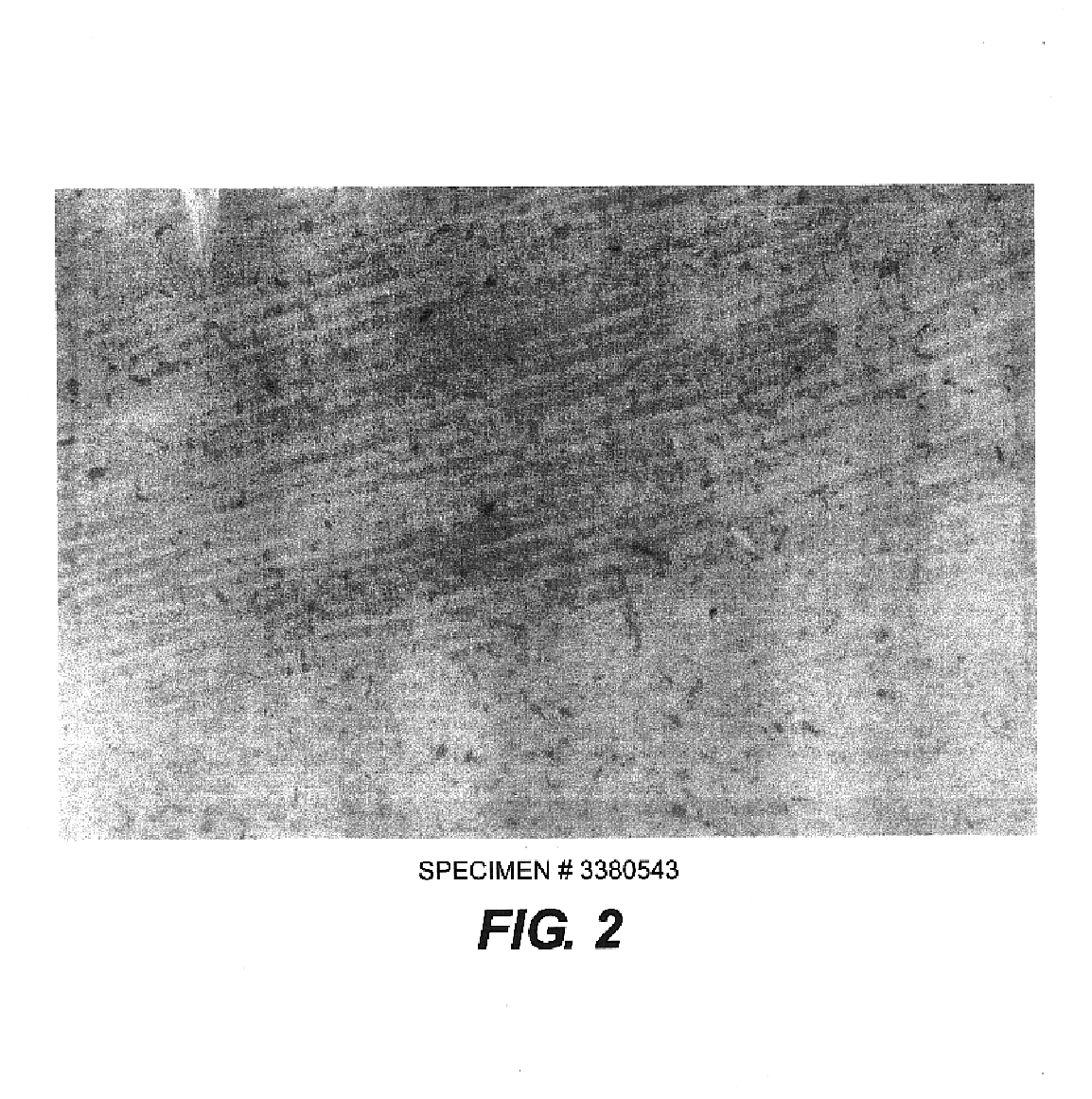 Composition for stabilizing corneal tissue during or after orthokeratology lens wear