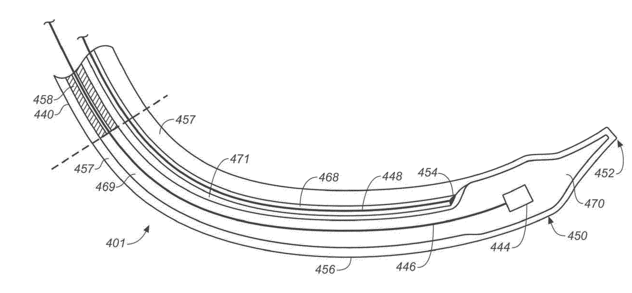 Diagnostic catheters, guide catheters, visualization devices and chord manipulation devices, and related kits and methods