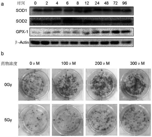 Application of cordycepin in preparation of medicine for preventing and/or treating radiation damage