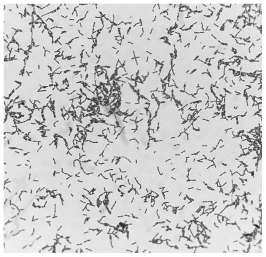 Bifidobacterium longum NX-4 and application thereof in preparing drugs for treating and/or preventing allergic diseases