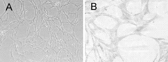 Efficient amplifying and culturing method for biliary epithelial cells