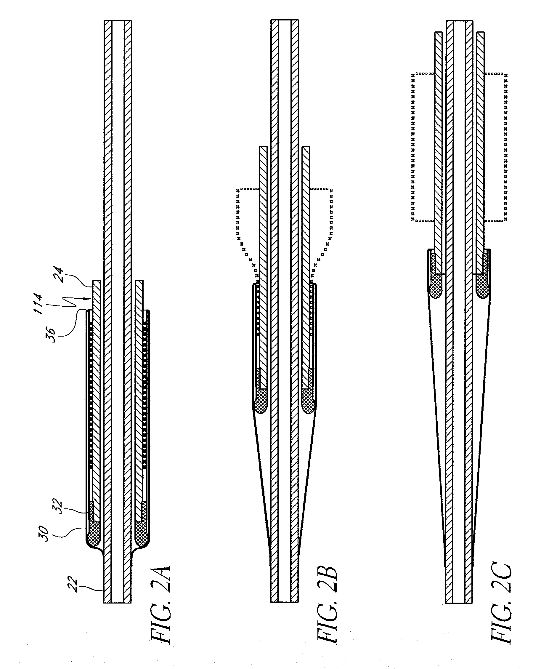 Delivery system for deployment of medical devices
