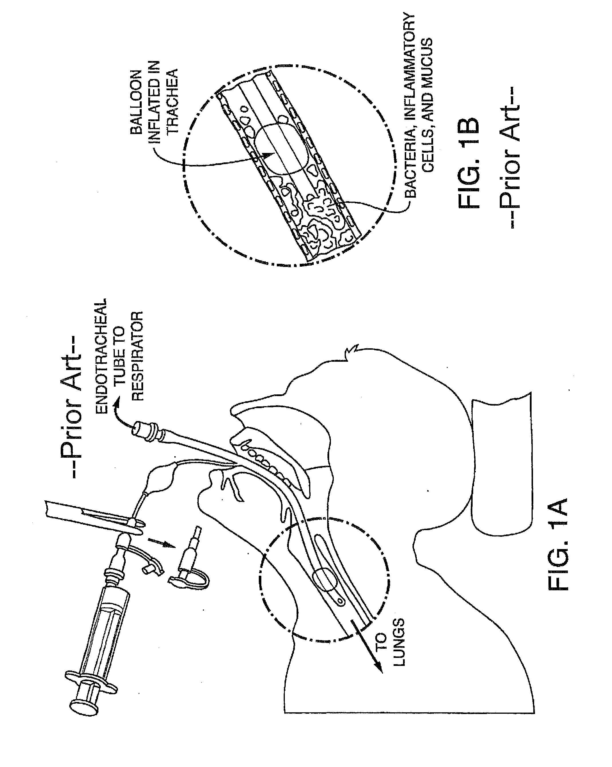 Methods, devices and Formulations For Targeted Endobronchial Therapy