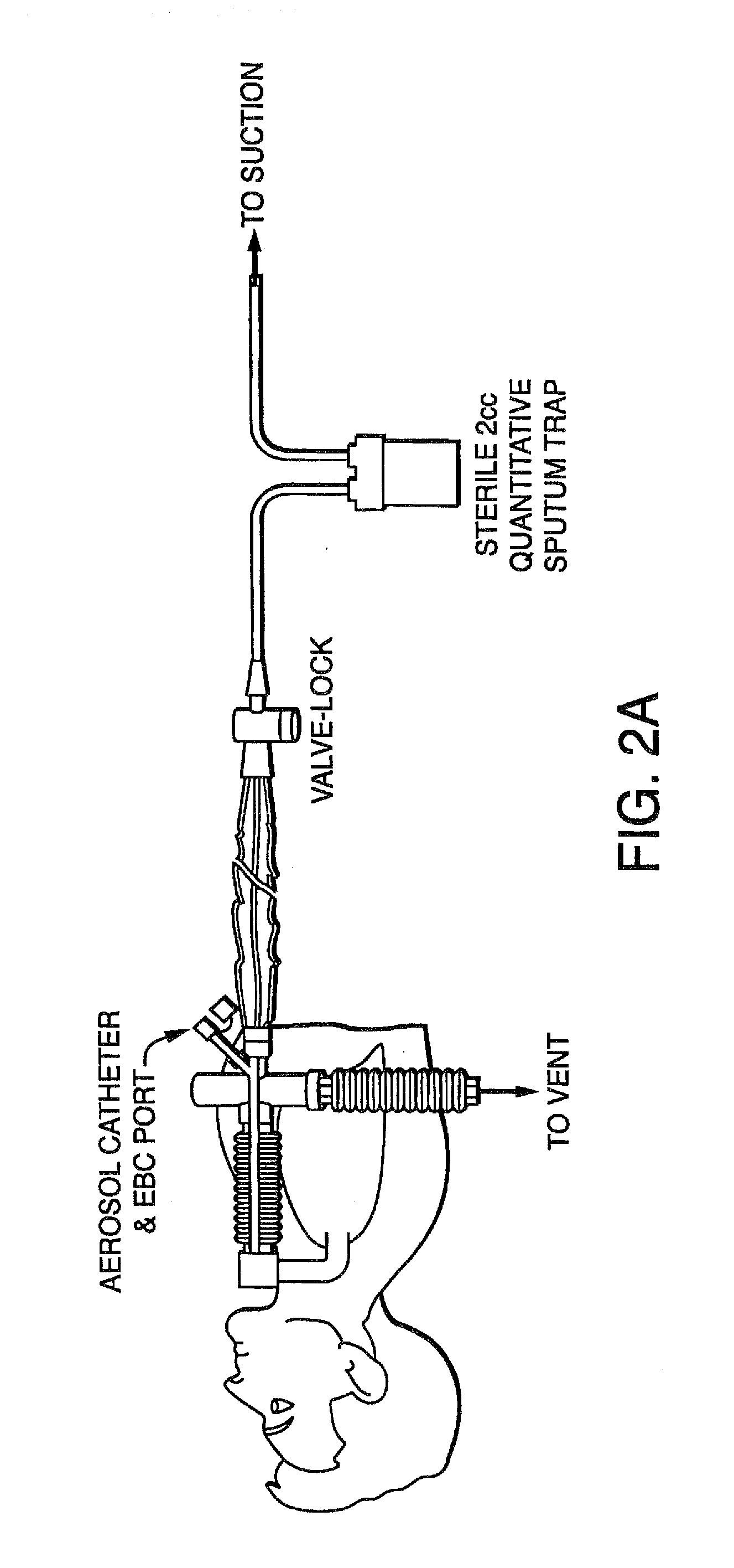 Methods, devices and Formulations For Targeted Endobronchial Therapy