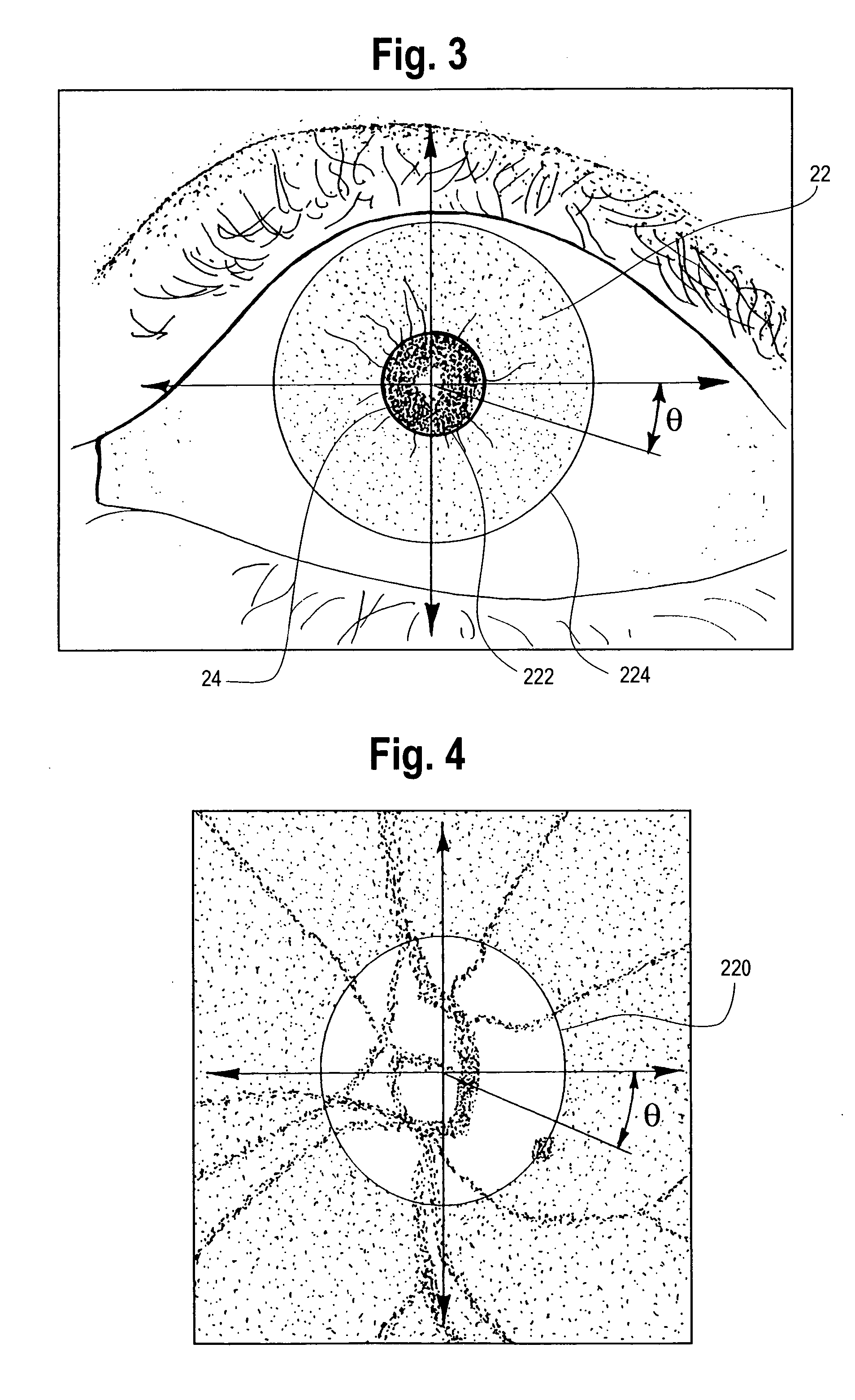 Method and system for generating a combined retina/iris pattern biometric