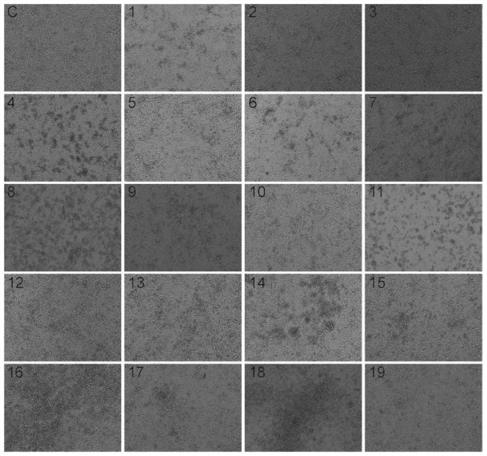 Method for constructing infected animal model by using coxsackie A2 virus strain and application of infected animal model