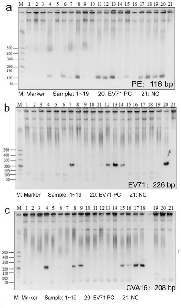 Method for constructing infected animal model by using coxsackie A2 virus strain and application of infected animal model