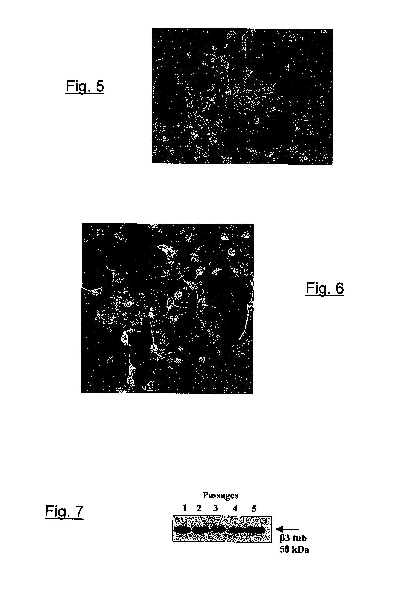 Method for production of neurons from cells of a cell line