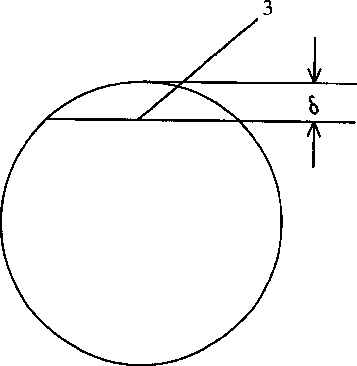 Metal inner needle of detention needle and the detention needle using same