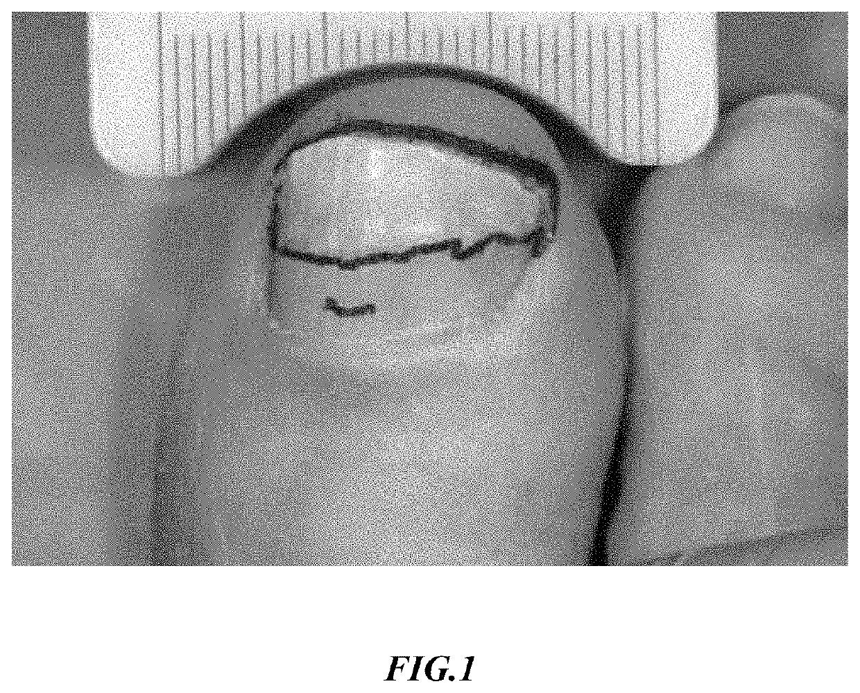 Onychomycosis treatment compositions and methods