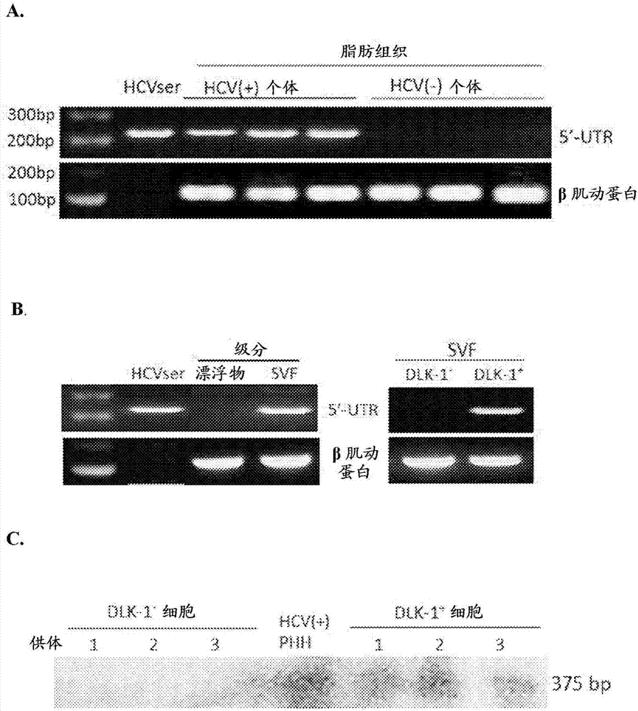 Employing human adipose-derived stem cells to propagate serum-derived hepatitis c virus and use thereof