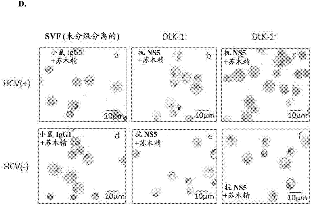 Employing human adipose-derived stem cells to propagate serum-derived hepatitis c virus and use thereof