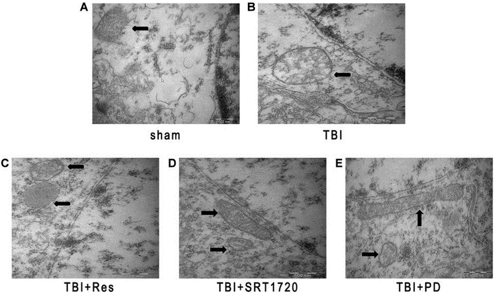 Applications of polydatin, and neuron mitochondrion injury treating medicine and preparation method thereof