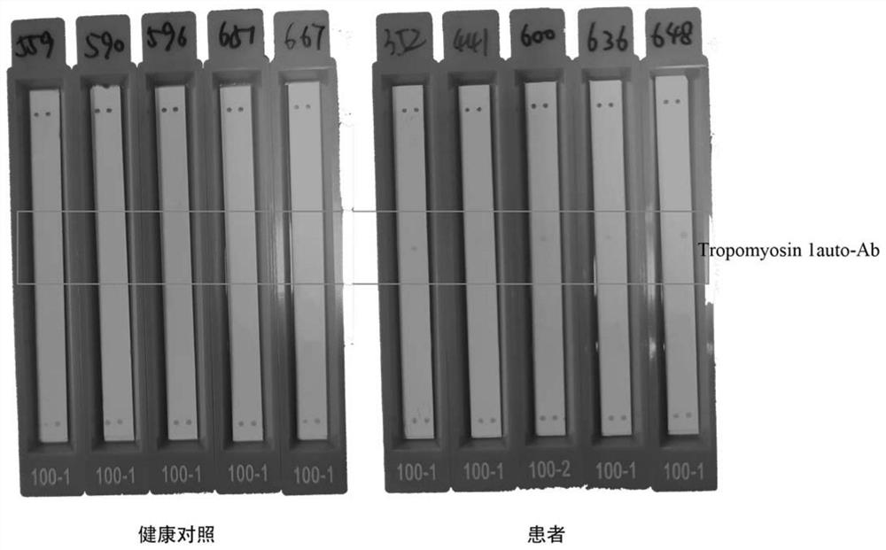 A kit for detecting antigen myosin 1-igg antibody