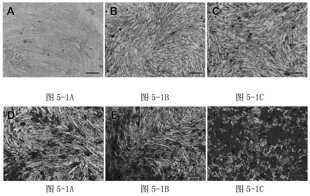 Application of histone deacetylase inhibitors in preparing osteoblast differentiation preparation of odontogenic stem cells