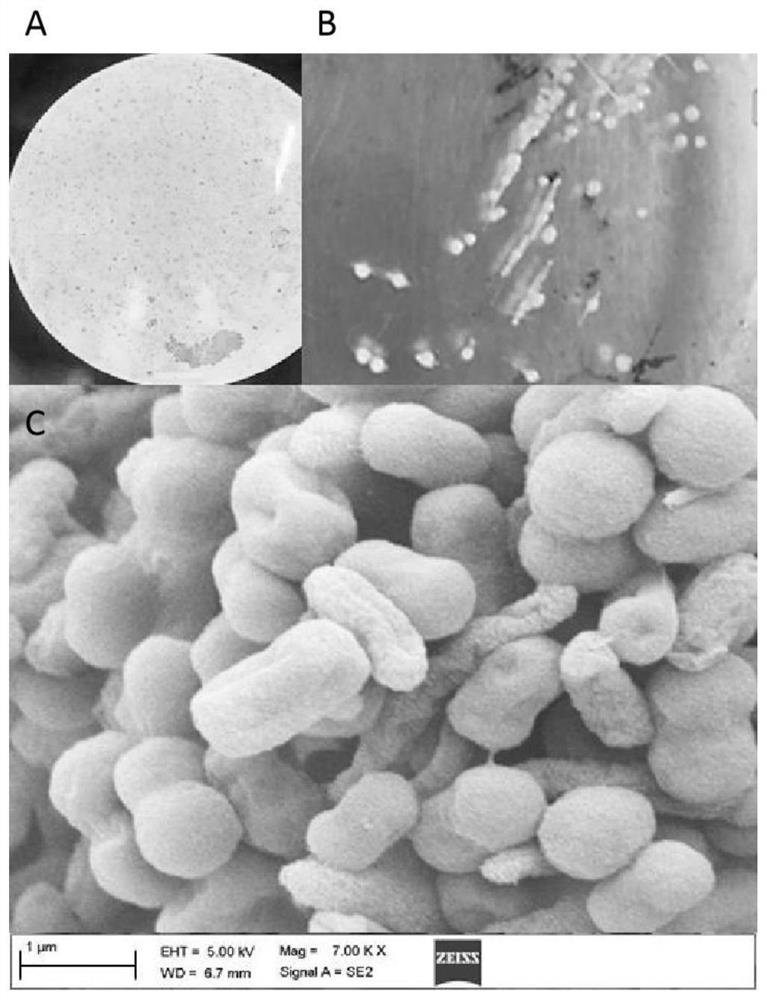Achromobacter strain JD417 and application thereof