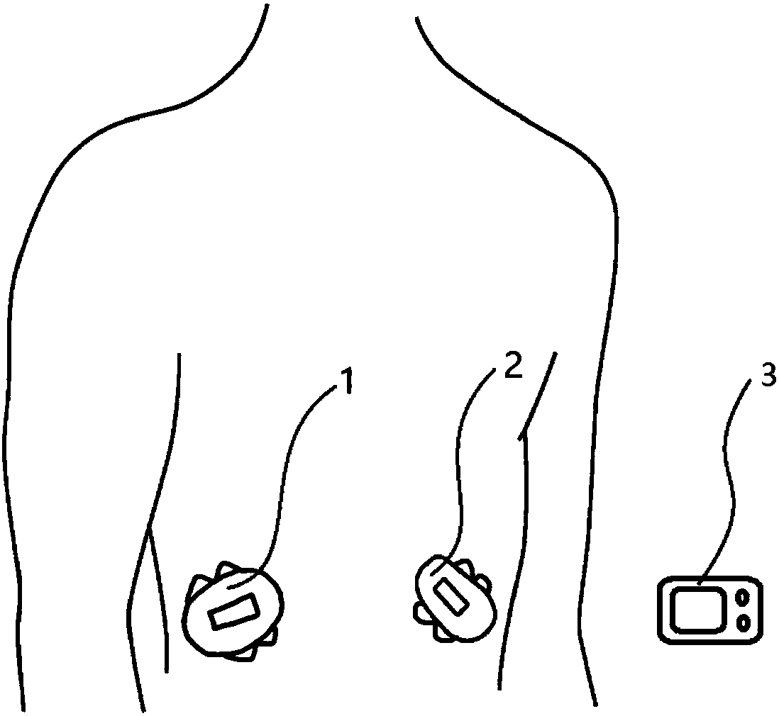 Artificial pancreas closed-loop control algorithm