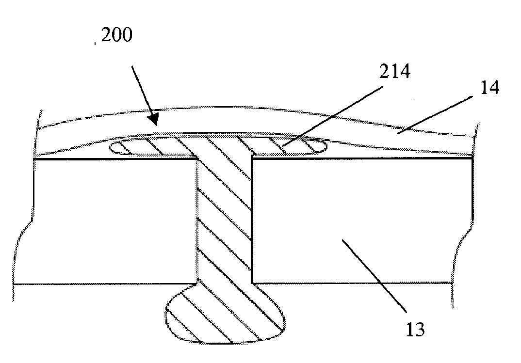 Wound Closure Devices, Methods of Use, and Kits