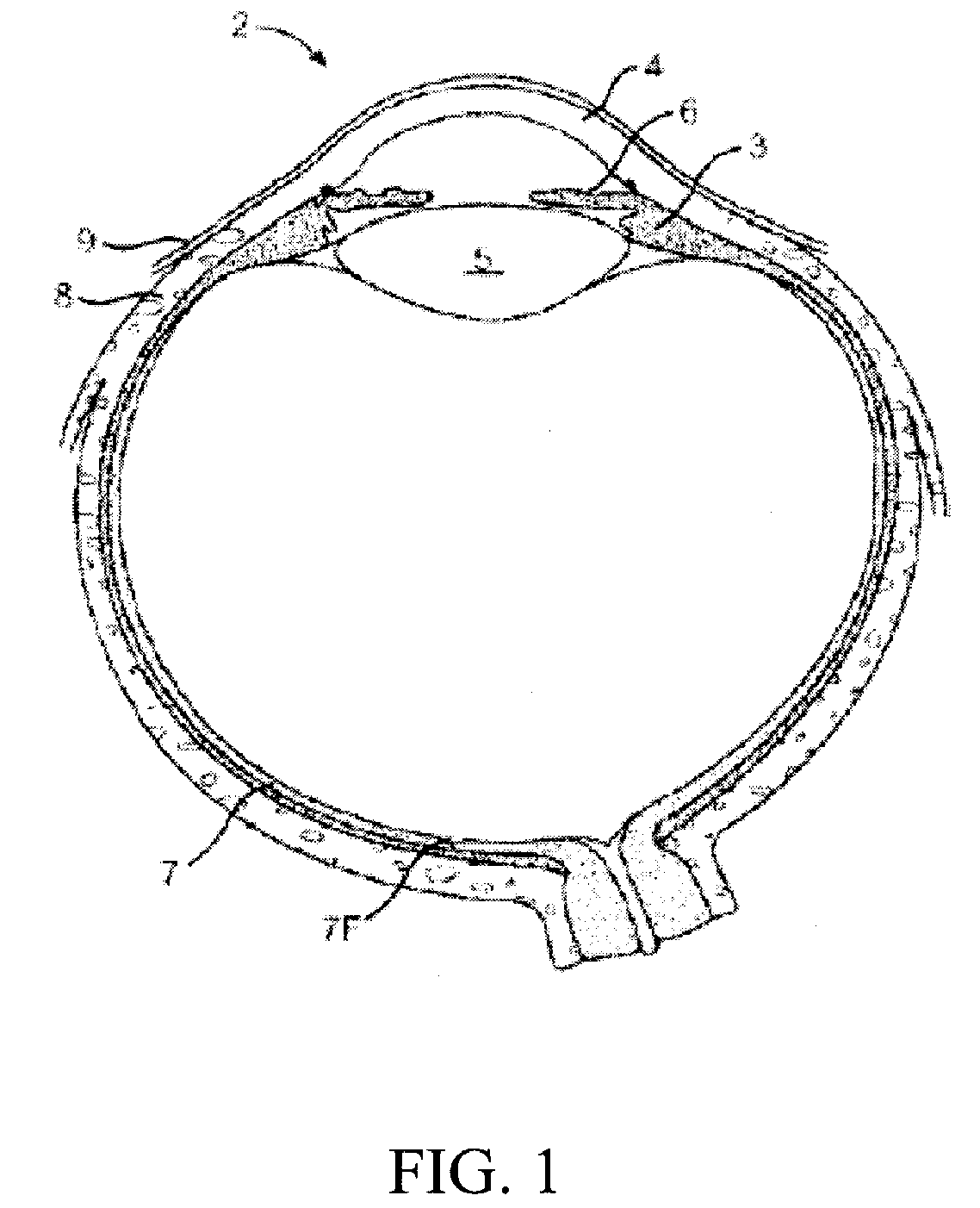 Wound Closure Devices, Methods of Use, and Kits