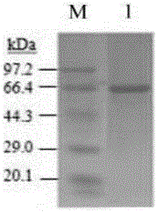 Pichia pastoris gene engineering bacteria for recombinant expression of human glutamic acid decarboxylase