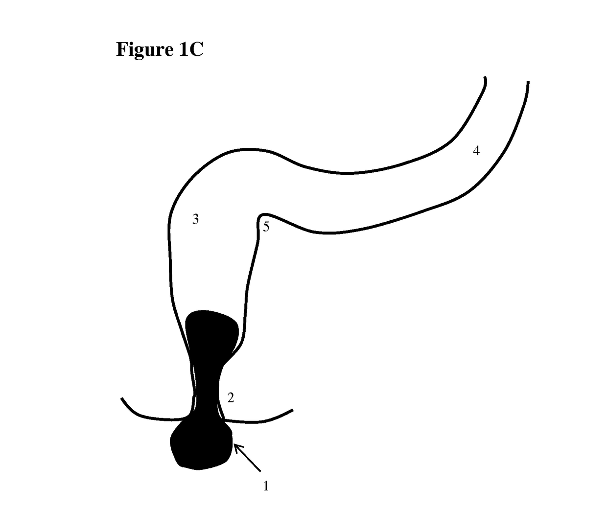 Apparatus for testing distal colonic and anorectal function