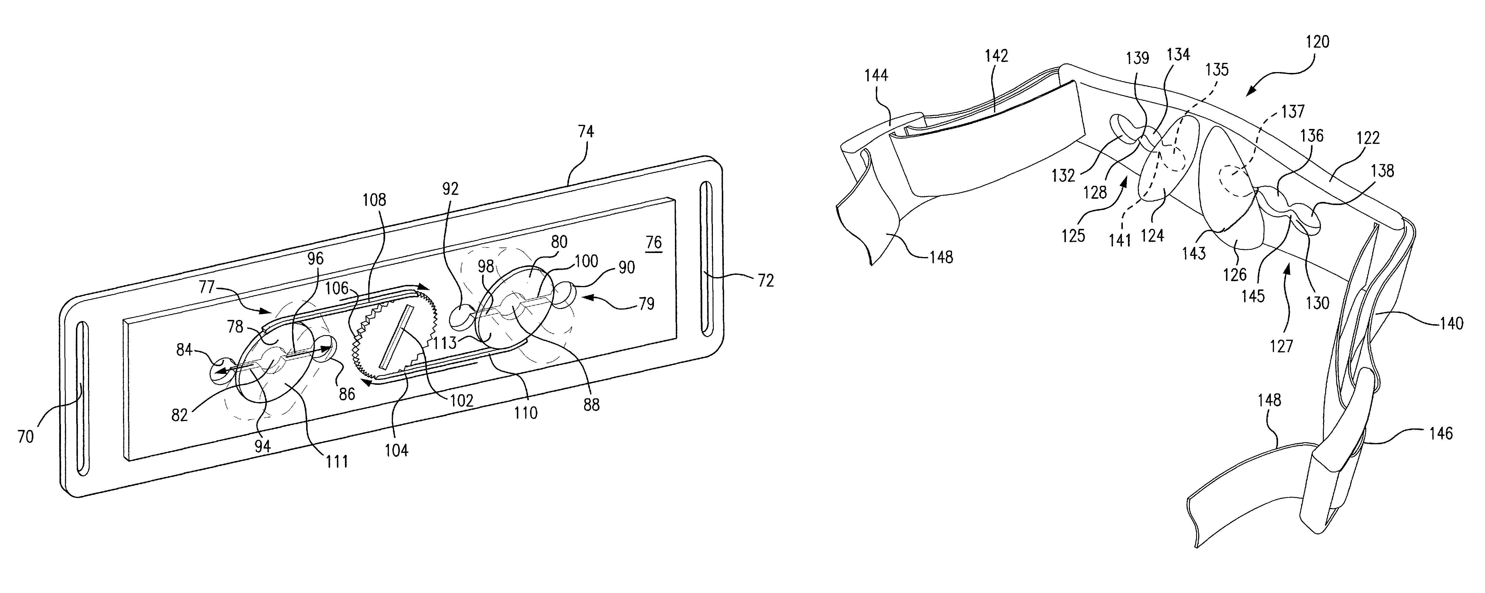 Anti-reflux/heartburn treatment device