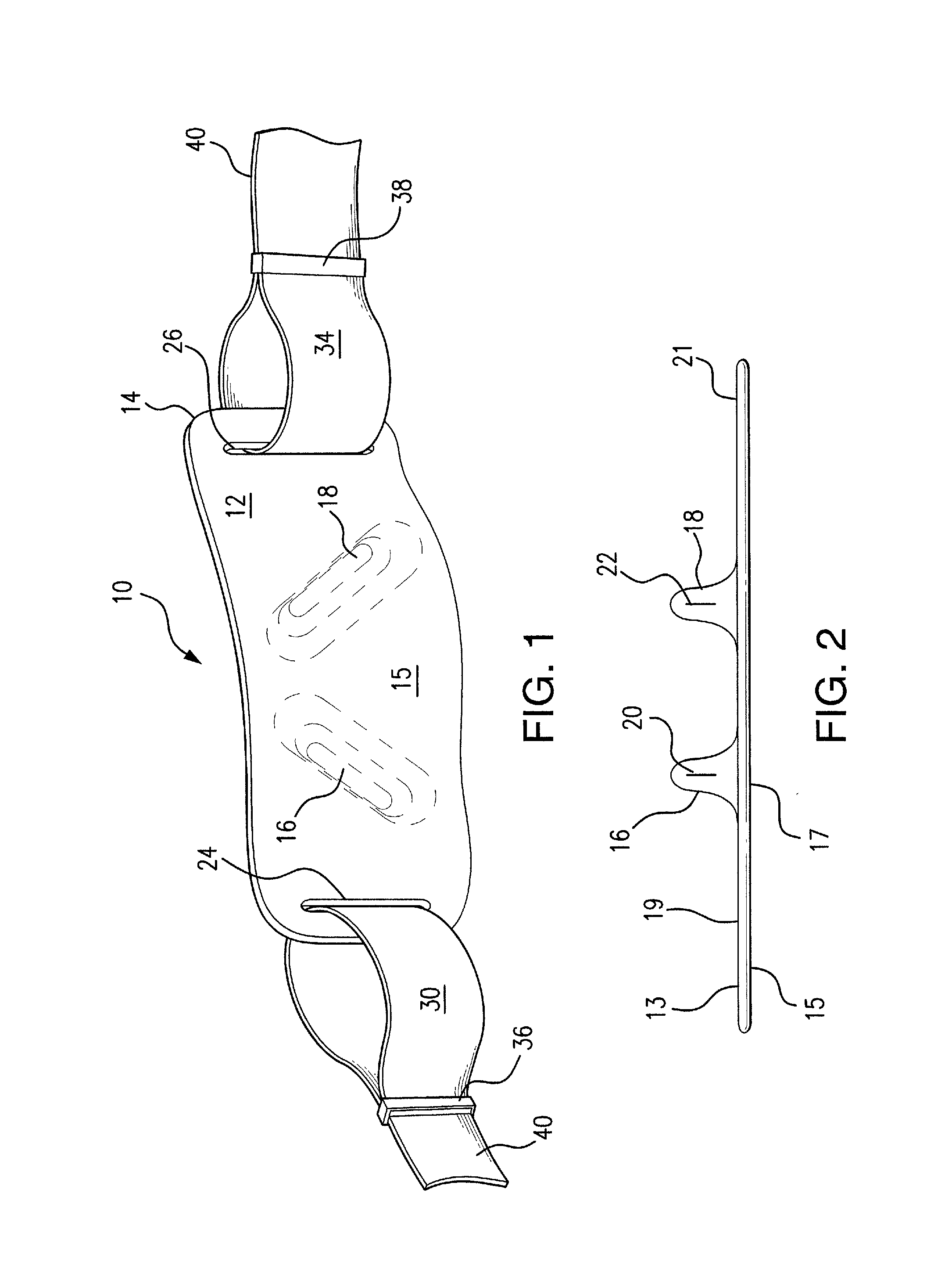 Anti-reflux/heartburn treatment device