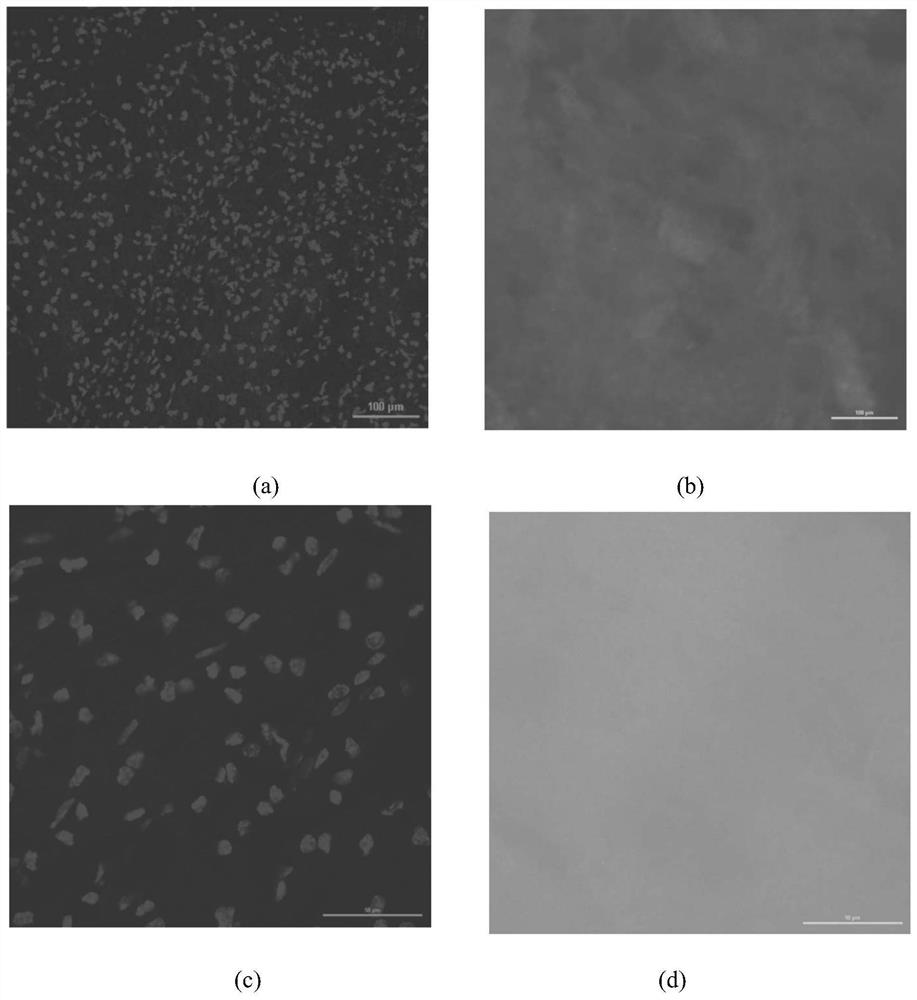 Preparation method of brain acellular matrix