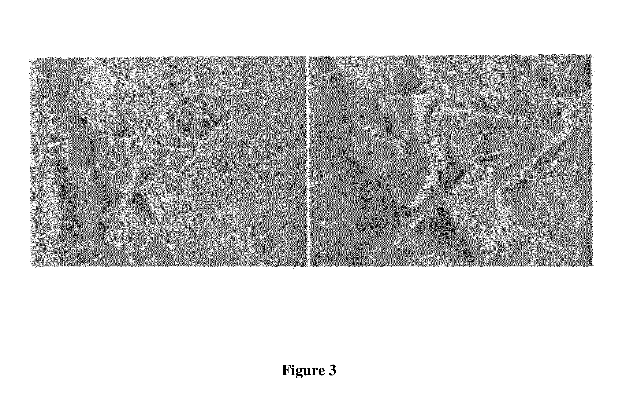 Methods And Compositions For Reducing Pain, Inflammation, And/Or Immunological Reactions Associated With Parenterally Administering A Primary Therapeutic Agent