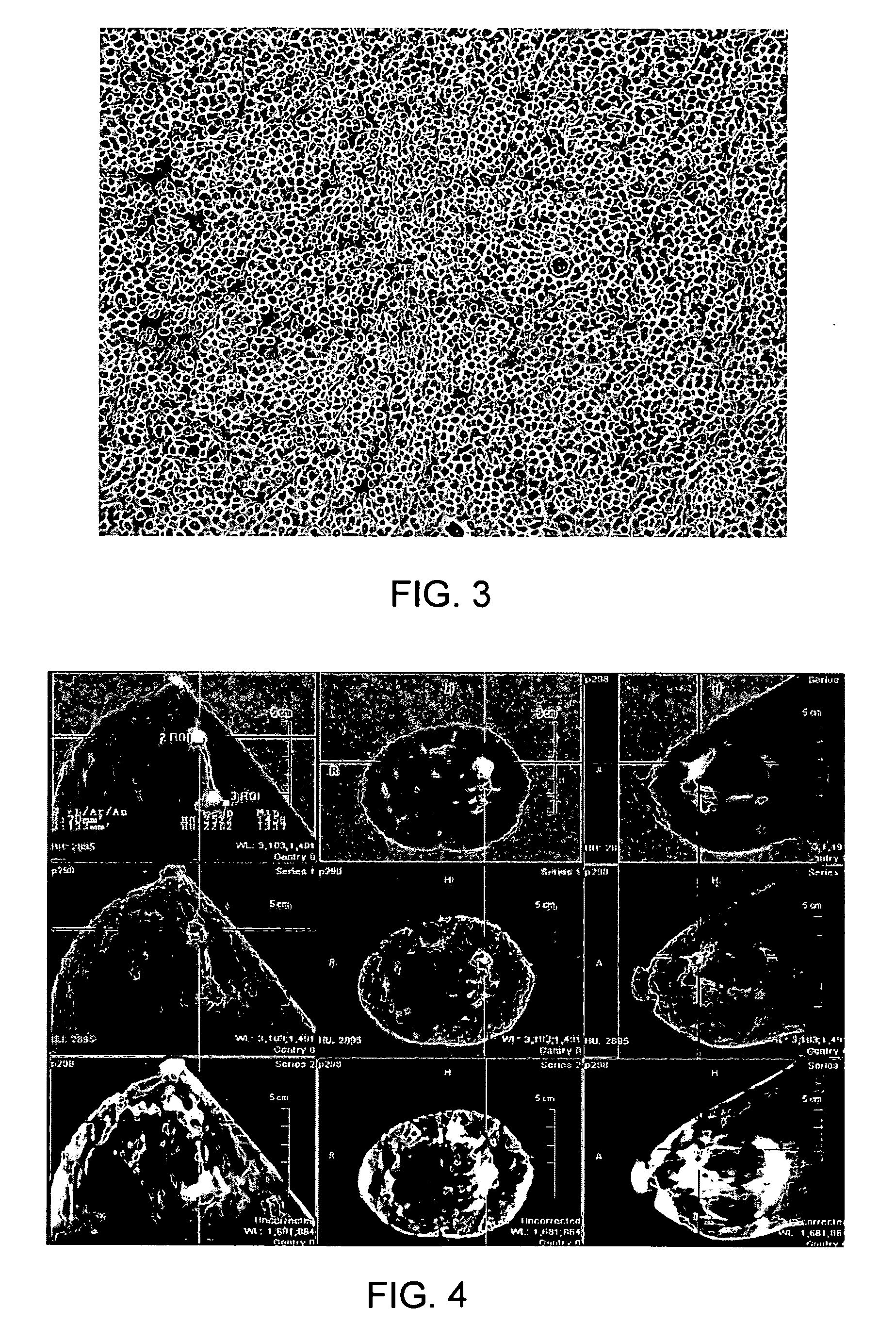 Imaging System Eureka Patsnap Develop Intelligence Library 1615