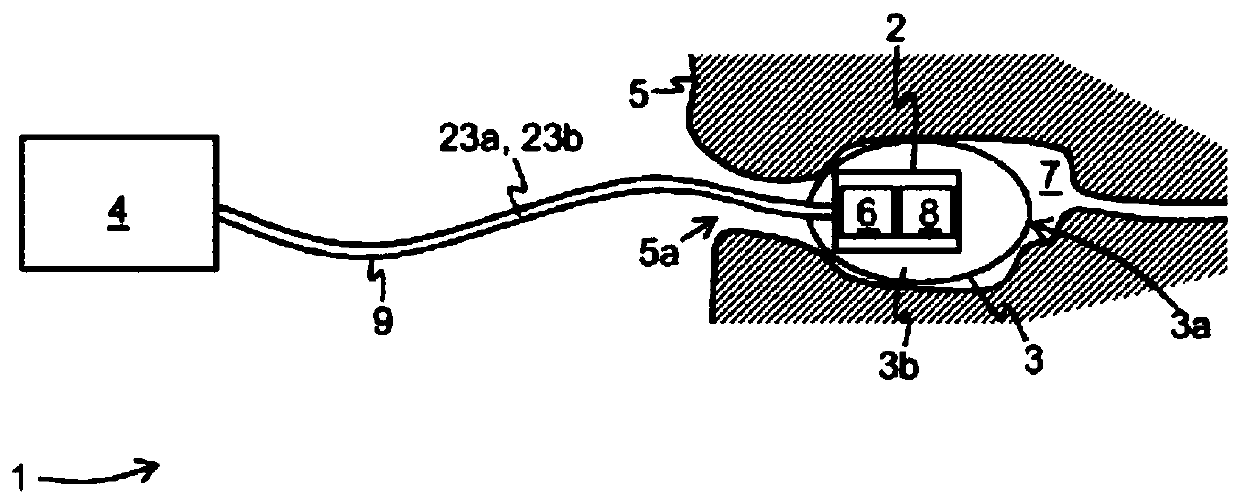 Device for endoscopic optoacoustic imaging, in particular for endoscopic optoacoustic imaging of cavities and hollow objects