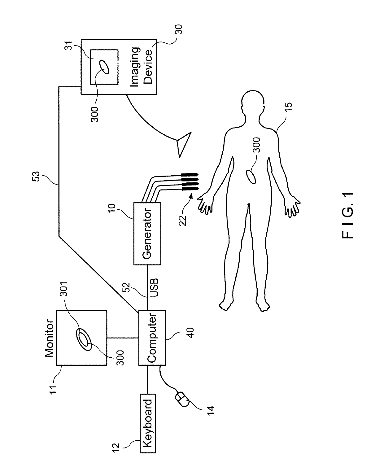 System and method for ablating a tissue site by electroporation with real-time monitoring of treatment progress