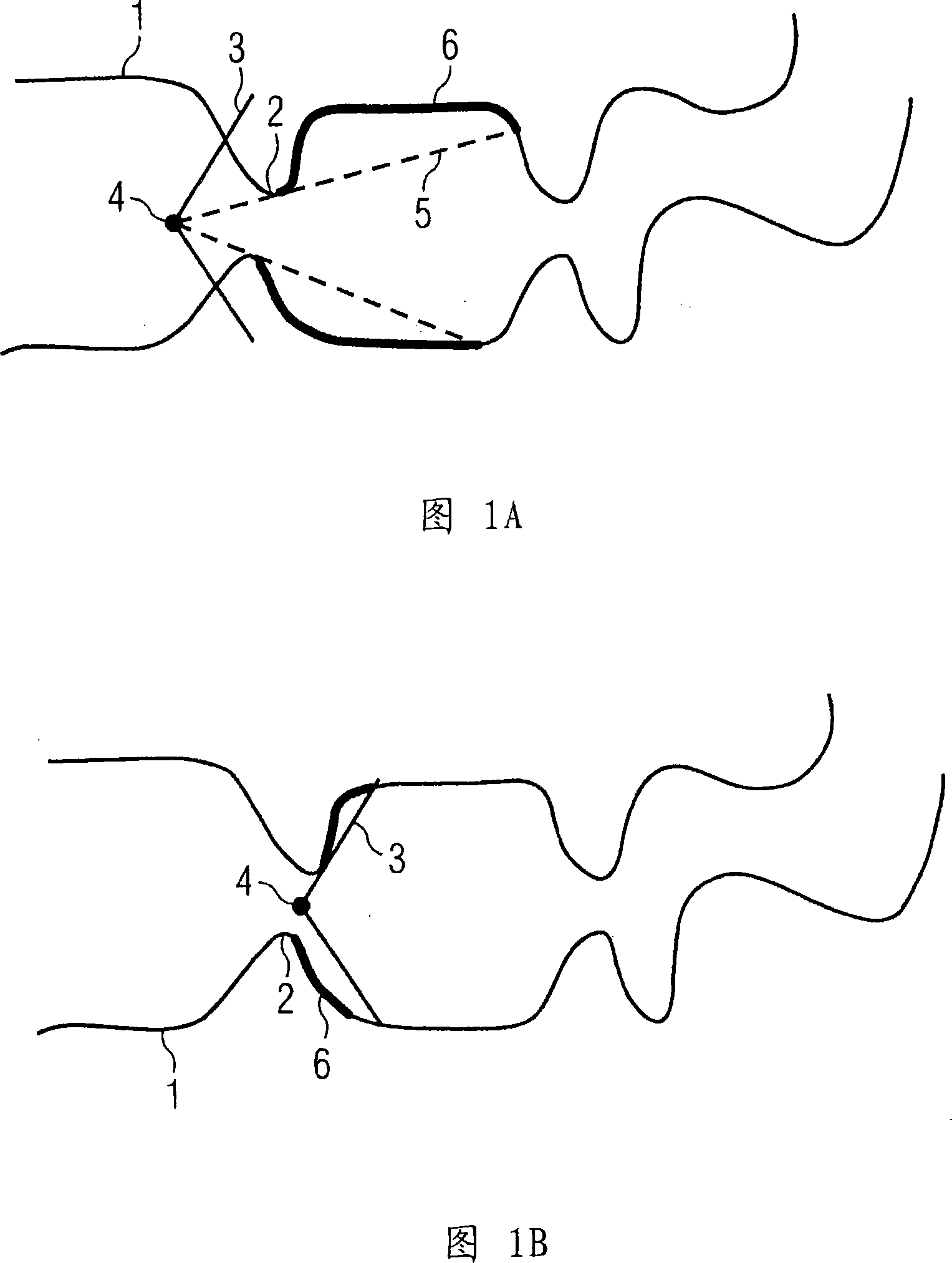 Method and apparatus for examining hollow lumen by virtual endoscope