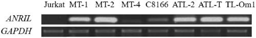 Therapeutic drug for ALT (adult T-cell leukemia) and diagnostic kit