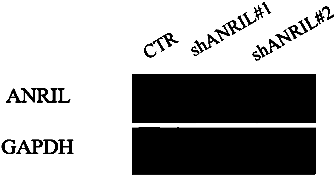 Therapeutic drug for ALT (adult T-cell leukemia) and diagnostic kit