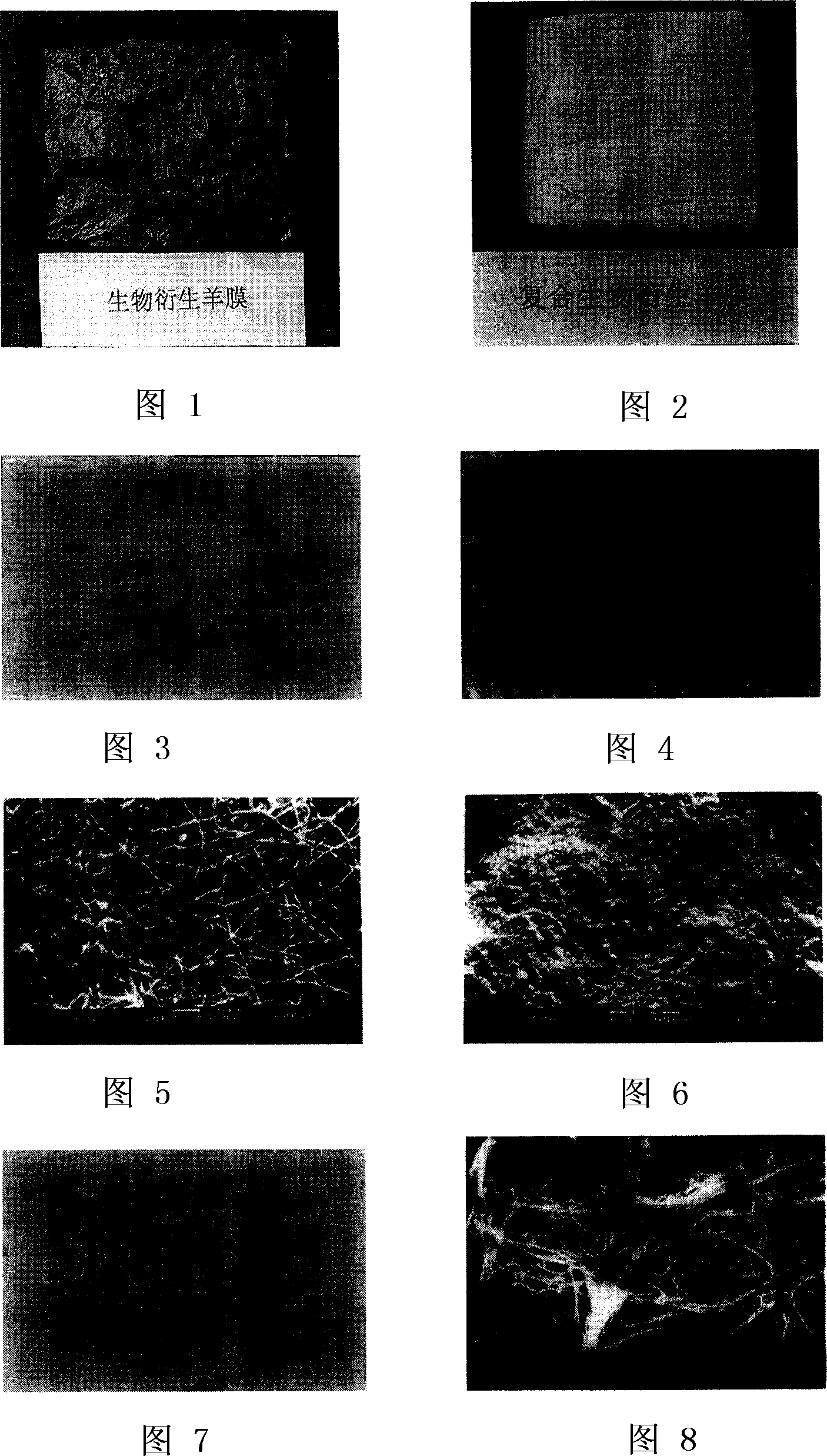 Bioderived amnion, composite bioderived amnion and its preparation method