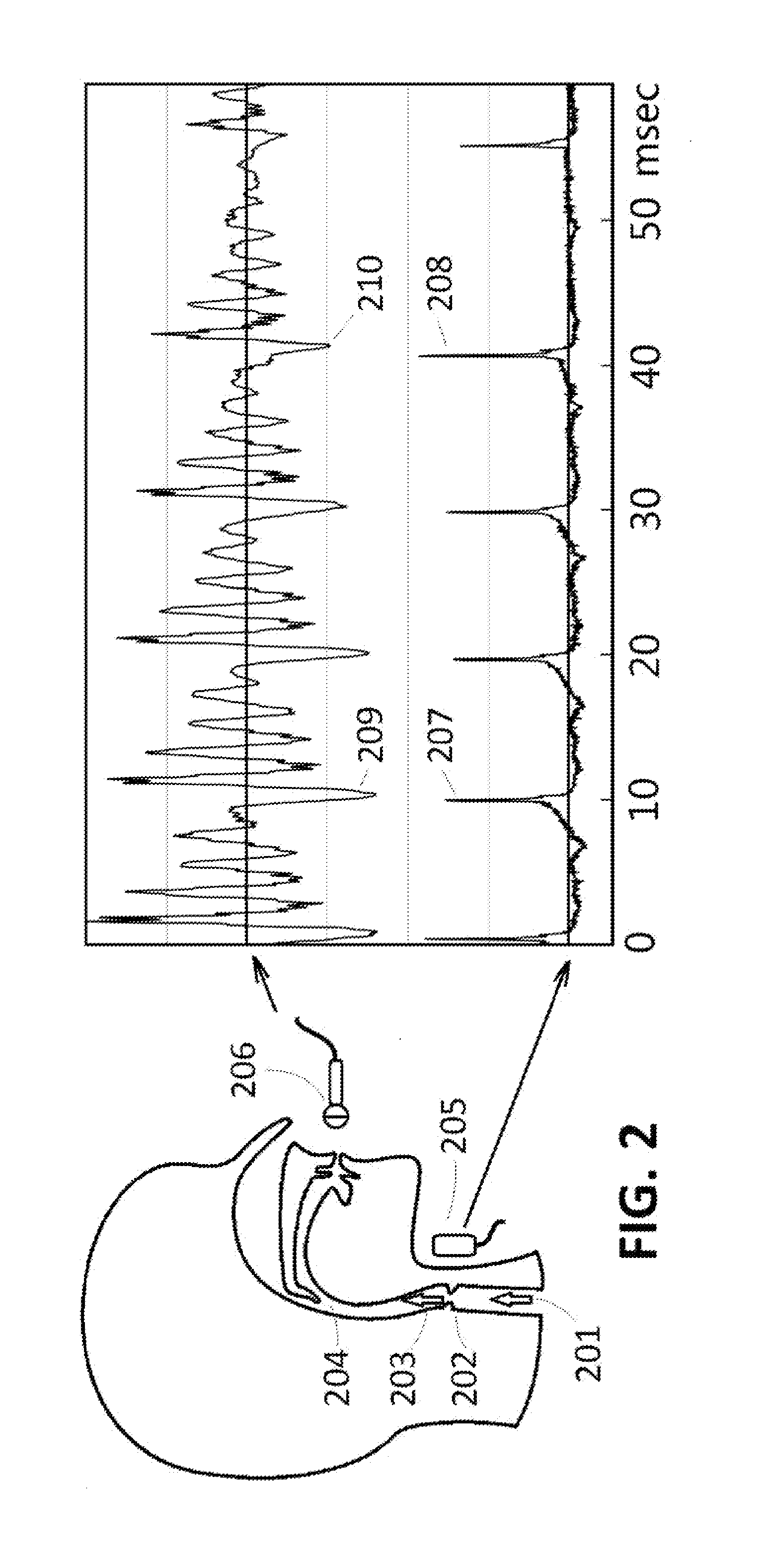 System and method for speech synthesis