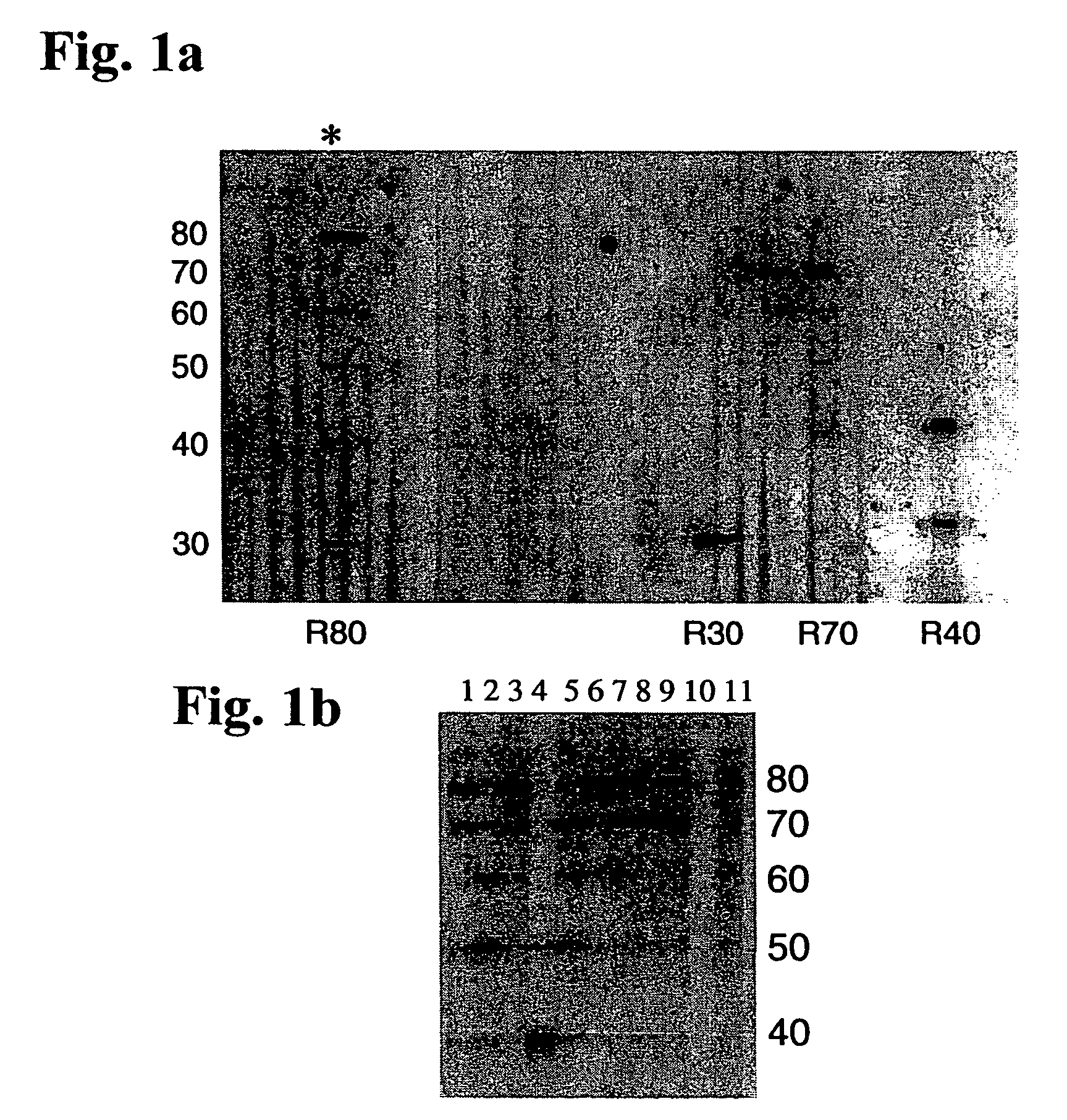 Spinocerebellar ataxia type 8 and methods of detection