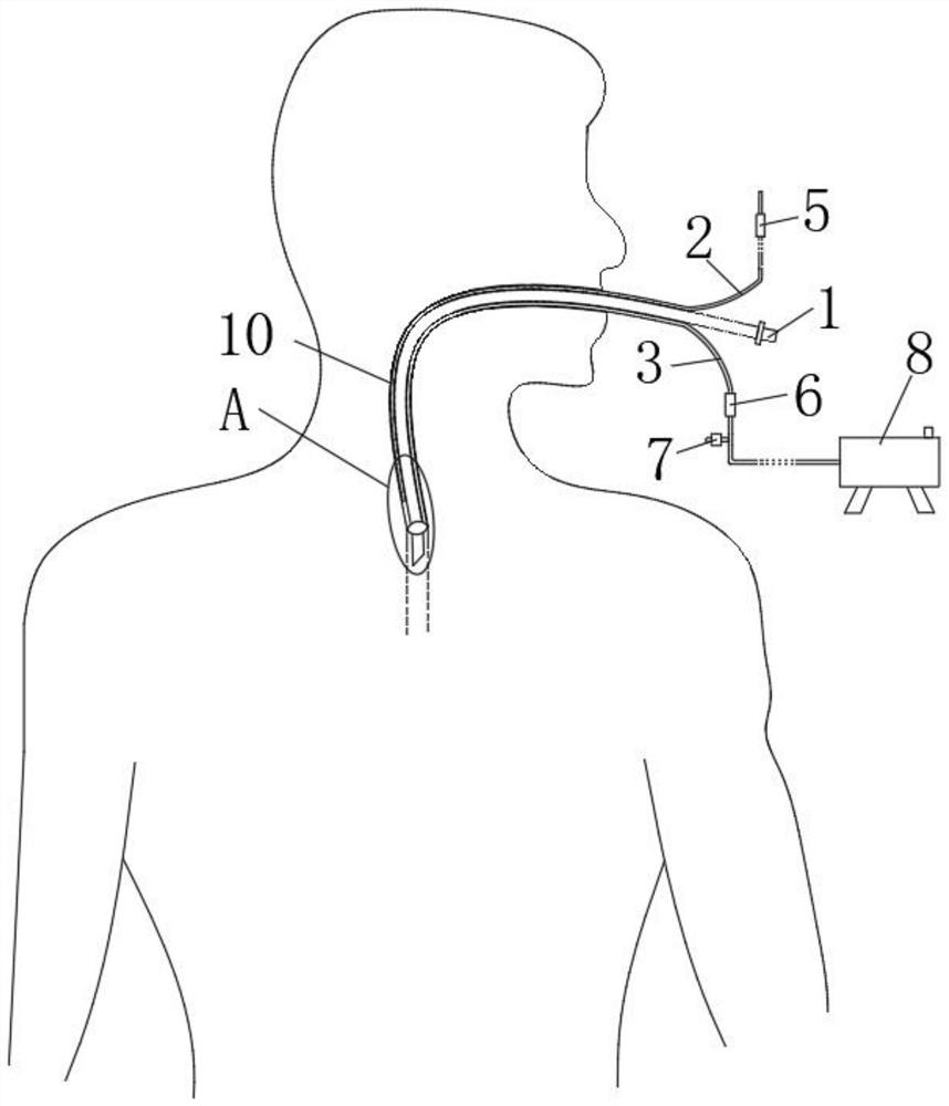 Air bag pressure management device used in invasive positive pressure ventilation operation