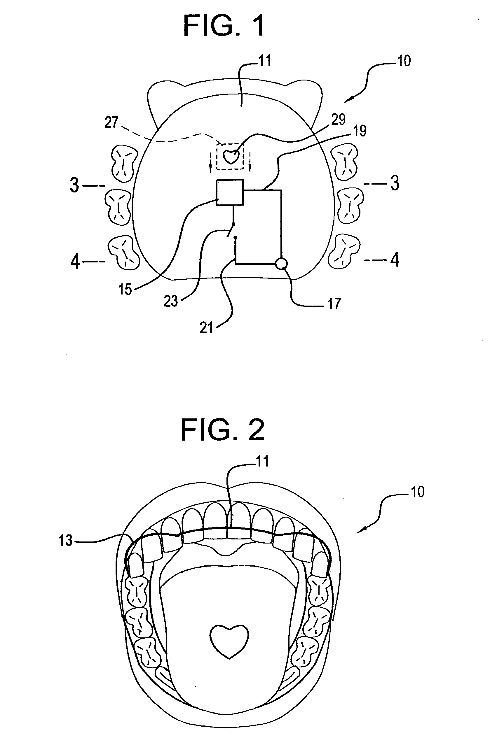 Illuminated orthodontic retainer and case therefor