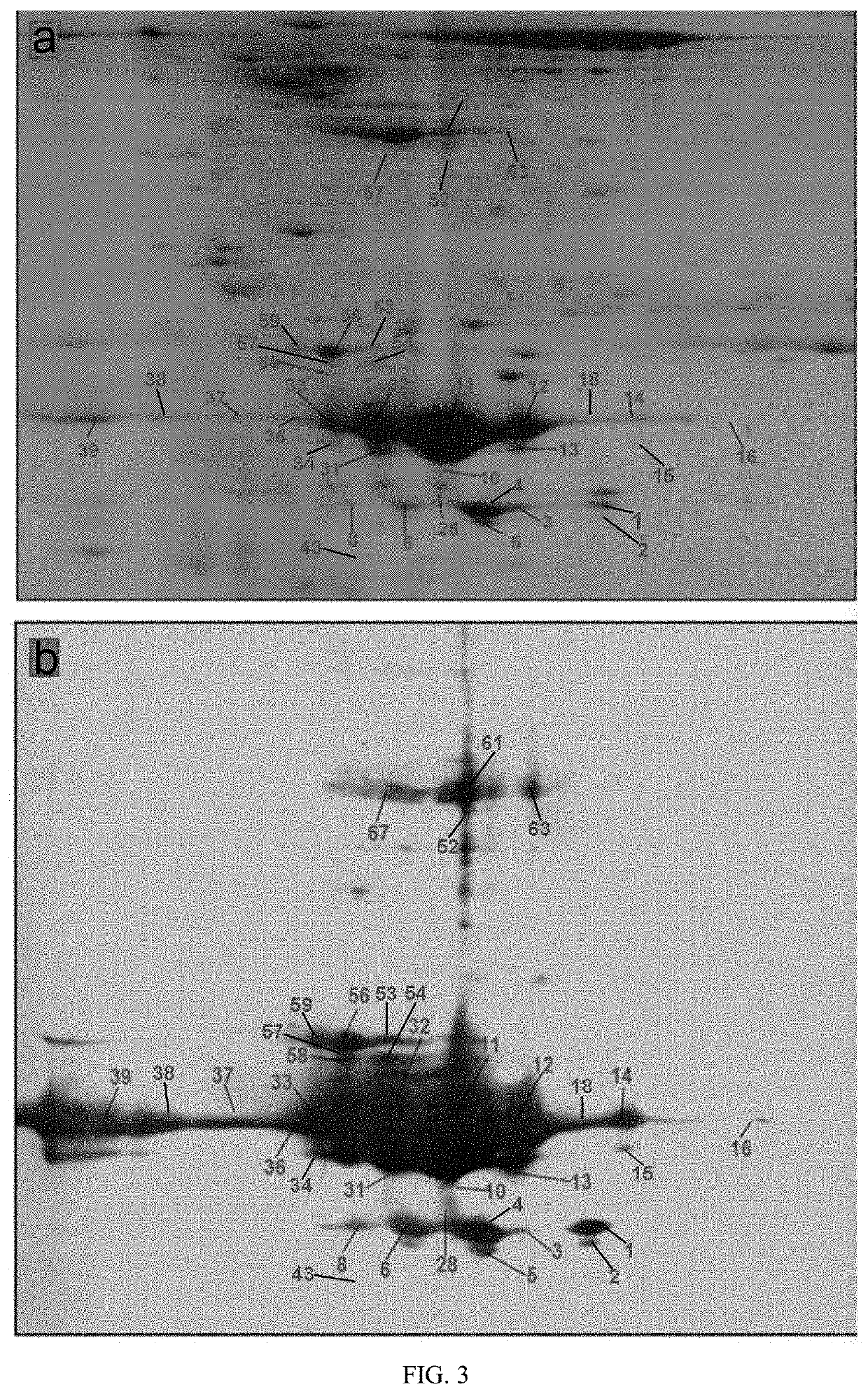 Method for Identifying Human Growth Hormone Proteoform (hGHP) Pattern Biomarker